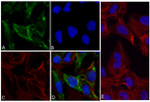 Phospho-p70 S6 Kinase (Thr421, Ser424) Antibody in Immunocytochemistry (ICC/IF)