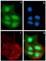 alpha Synuclein Antibody in Immunocytochemistry (ICC/IF)