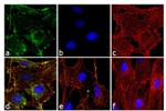 Phospho-AKT1 (Thr308) Antibody in Immunocytochemistry (ICC/IF)