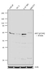 Phospho-AKT1 (Thr308) Antibody in Western Blot (WB)