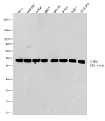 GSK3B Antibody in Western Blot (WB)