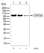 STAT5 beta Antibody in Western Blot (WB)