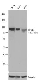 STAT6 Antibody in Western Blot (WB)