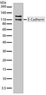 E-cadherin Antibody in Western Blot (WB)