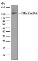 PDGFRA Antibody in Western Blot (WB)