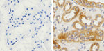 beta Amyloid Antibody in Immunohistochemistry (Paraffin) (IHC (P))