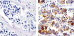 Metadherin Antibody in Immunohistochemistry (Paraffin) (IHC (P))