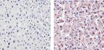 CRP Antibody in Immunohistochemistry (Paraffin) (IHC (P))