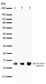 beta-2 Microglobulin Antibody in Western Blot (WB)