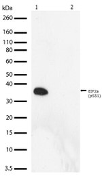 Phospho-EIF2S1 (Ser51) Antibody in Western Blot (WB)