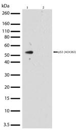 Acetyl-p53 (Lys382) Antibody