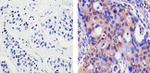 Acetyl-p53 (Lys382) Antibody in Immunohistochemistry (Paraffin) (IHC (P))