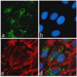 Phospho-Tau (Ser396) Antibody in Immunocytochemistry (ICC/IF)