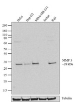 MMP3 Antibody in Western Blot (WB)