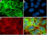 MMP13 Antibody in Immunocytochemistry (ICC/IF)