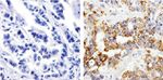 MMP13 Antibody in Immunohistochemistry (Paraffin) (IHC (P))