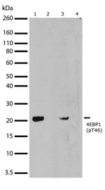 Phospho-4EBP1 (Thr46) Antibody in Western Blot (WB)