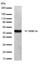 MMP16 Antibody in Western Blot (WB)