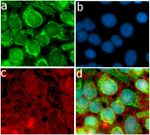 Ubiquitin Antibody in Immunocytochemistry (ICC/IF)