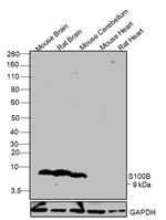 S100B Antibody