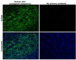 S100B Antibody in Immunohistochemistry (Paraffin) (IHC (P))