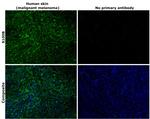 S100B Antibody in Immunohistochemistry (Paraffin) (IHC (P))