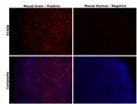 S100B Antibody in Immunohistochemistry (Paraffin) (IHC (P))