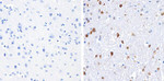 S100B Antibody in Immunohistochemistry (Paraffin) (IHC (P))