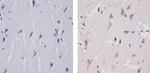 TNFR1 Antibody in Immunohistochemistry (Paraffin) (IHC (P))