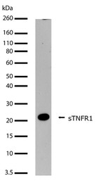 TNFR1 Antibody in Western Blot (WB)