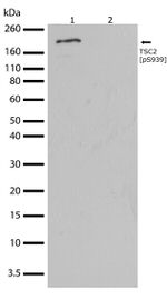 Phospho-TSC2 (Ser939) Antibody in Western Blot (WB)