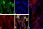 Alpha-Smooth Muscle Actin Antibody in Immunocytochemistry (ICC/IF)