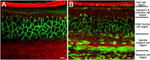 Connexin 26 Antibody in Immunohistochemistry (IHC)