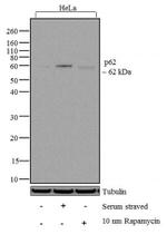 SQSTM1 Antibody