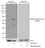 Phospho-SMAD2 (Ser465, Ser467) Antibody in Western Blot (WB)