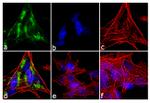 Huntingtin Antibody in Immunocytochemistry (ICC/IF)