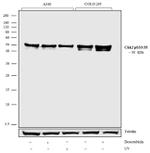 Phospho-CHK2 (Ser33, Ser35) Antibody in Western Blot (WB)