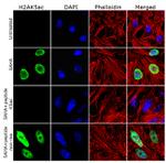 H2AK5ac Antibody