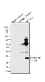 p19 INK4d Antibody in Immunoprecipitation (IP)