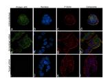 Protein APC Antibody