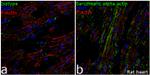 alpha Actinin 2 Antibody in Immunohistochemistry (Frozen) (IHC (F))