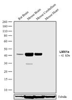 LMX1A Antibody in Western Blot (WB)