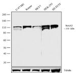 NOTCH2 Antibody in Western Blot (WB)