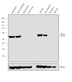 GLT-1 Antibody in Western Blot (WB)