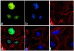 EVI1 Antibody in Immunocytochemistry (ICC/IF)