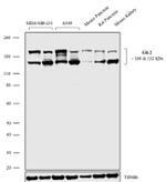 GLI2 Antibody in Western Blot (WB)