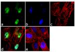 MECP2 Antibody in Immunocytochemistry (ICC/IF)