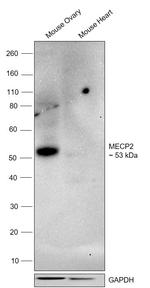 MECP2 Antibody in Western Blot (WB)