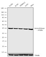 Aurora B Antibody in Western Blot (WB)