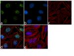 RAD1 Antibody in Immunocytochemistry (ICC/IF)